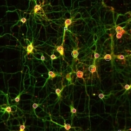 Neurons Localisation